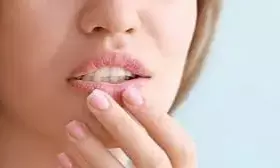 Lips Keep Cracking: పెదవులు పదే పదే పగులుతున్నాయా? అయితే మీ శరీరంలో ఈ పోషకాల లోపం ఉన్నట్లే.. Lips Keep Cracking: పెదవులు పదే పదే పగులుతున్నాయా? అయితే మీ శరీరంలో ఈ పోషకాల లోపం ఉన్నట్లే..
