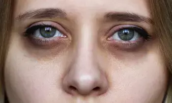 Dark Circles Under Your Eyes: కంటి కింద నల్లటి వలయాలు వేధిస్తున్నాయా? ఈ సింపుల్ ఇంటి చిట్కాలతో చెక్ పెట్టండి.. Dark Circles Under Your Eyes: కంటి కింద నల్లటి వలయాలు వేధిస్తున్నాయా? ఈ సింపుల్ ఇంటి చిట్కాలతో చెక్ పెట్టండి..