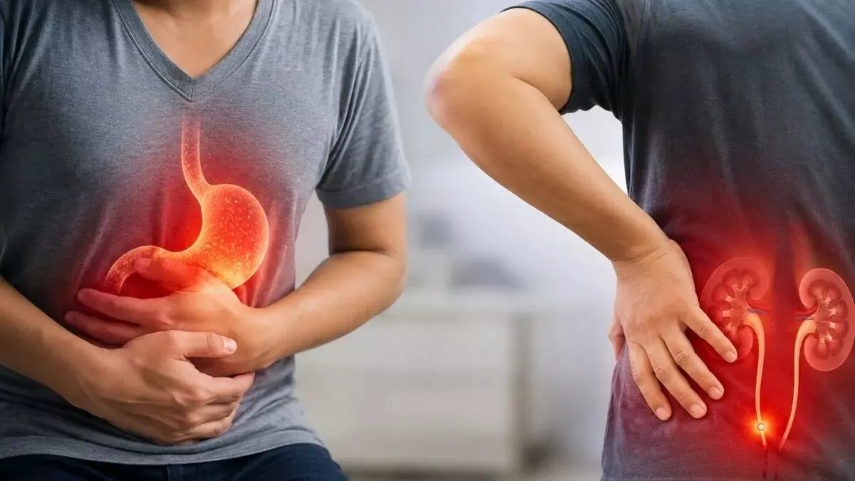 Acidity or Kidney Stones: ఎసిడిటీనా? కిడ్నీలో రాళ్ళా? ఈ లక్షణాలతో సులభంగా గుర్తించండి! Acidity or Kidney Stones: ఎసిడిటీనా? కిడ్నీలో రాళ్ళా? ఈ లక్షణాలతో సులభంగా గుర్తించండి!