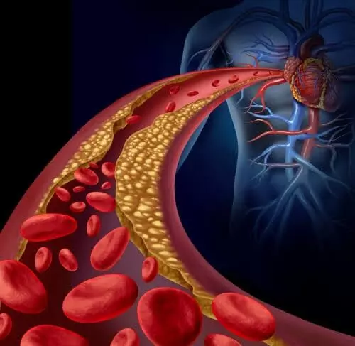 Heart Attack Risk: తెలిసి తెలియక చేసే పొరపాట్లతో గుండెపోటు ముప్పు.. హెచ్చరిస్తున్న సీనియర్ వైద్యులు.. Heart Attack Risk: తెలిసి తెలియక చేసే పొరపాట్లతో గుండెపోటు ముప్పు.. హెచ్చరిస్తున్న సీనియర్ వైద్యులు..