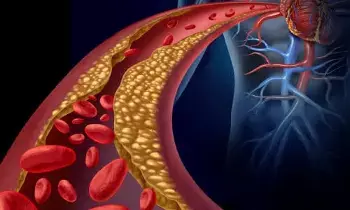 Heart Attack Risk: తెలిసి తెలియక చేసే పొరపాట్లతో గుండెపోటు ముప్పు.. హెచ్చరిస్తున్న సీనియర్ వైద్యులు.. Heart Attack Risk: తెలిసి తెలియక చేసే పొరపాట్లతో గుండెపోటు ముప్పు.. హెచ్చరిస్తున్న సీనియర్ వైద్యులు..