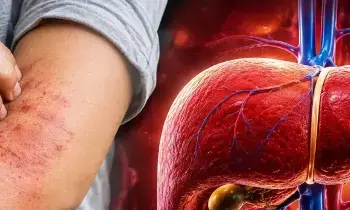 Liver Problems: చర్మంపై ఈ మార్పులు కనిపిస్తున్నాయా? లివర్ ప్రమాదంలో పడిందనడానికి ఇవే సంకేతాలు..