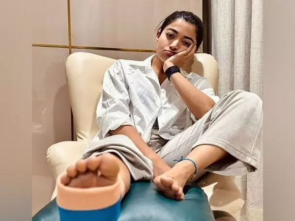 Rashmika Mandanna: షూటింగ్లో గాయపడిన రష్మిక మందన్న..ఆరు వారాల పాటు విశ్రాంతి Rashmika Mandanna: షూటింగ్లో గాయపడిన రష్మిక మందన్న..ఆరు వారాల పాటు విశ్రాంతి