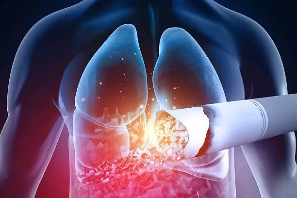 Lung Cancer: సిగరెట్ కాల్చని వారికి లంగ్ క్యాన్సర్ వస్తుందా.? Lung Cancer: సిగరెట్ కాల్చని వారికి లంగ్ క్యాన్సర్ వస్తుందా.?