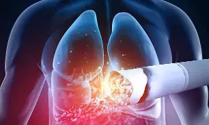 Lung Cancer: సిగరెట్ కాల్చని వారికి లంగ్ క్యాన్సర్ వస్తుందా.? Lung Cancer: సిగరెట్ కాల్చని వారికి లంగ్ క్యాన్సర్ వస్తుందా.?
