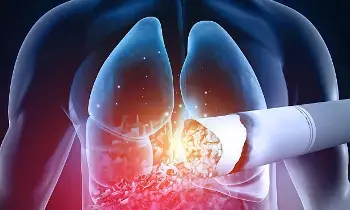 Lung Cancer: సిగరెట్ కాల్చని వారికి  లంగ్ క్యాన్సర్ వస్తుందా.?