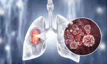 Lung Cancer Without Smoking: స్మోకింగ్ చేయకపోయినా ఊపిరితిత్తుల క్యాన్సర్.. భారత్‌లో షాకింగ్ నిజాలు