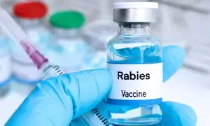 Rabies After Vaccination: వ్యాక్సిన్ వేసుకున్నా రేబీస్ వ్యాధి వస్తుందా? నిపుణులు చెబుతున్న చేదు నిజాలివే..