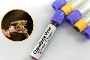 Chandipura Virus: చండీపుర వైరస్ అంటే ఏంటి.? వాటి లక్షణాలు, నివారణ మార్గాలు Chandipura Virus: చండీపుర వైరస్ అంటే ఏంటి.? వాటి లక్షణాలు, నివారణ మార్గాలు