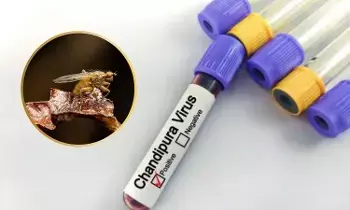 Chandipura Virus: చండీపుర వైరస్  అంటే ఏంటి.? వాటి   లక్షణాలు, నివారణ మార్గాలు