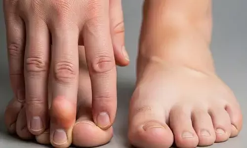 Sudden Swelling in Your Hands or Legs: చేతులు, కాళ్లలో ఉన్నట్లుండి వాపు వస్తోందా? నిర్లక్ష్యం చేస్తే ప్రమాదమే..