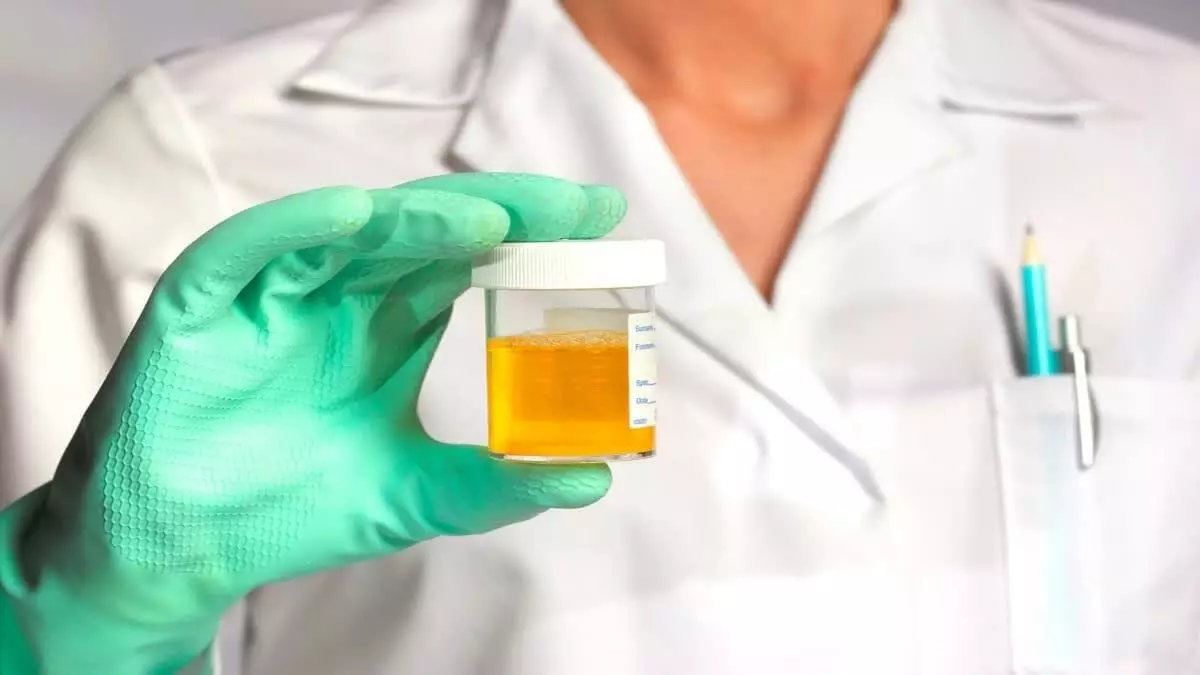 Yellow Urine Indicate a Liver Problem: పసుపు రంగు మూత్రం కాలేయ సమస్యకు సంకేతమా? నిపుణుల కీలక విశ్లేషణ.. Yellow Urine Indicate a Liver Problem: పసుపు రంగు మూత్రం కాలేయ సమస్యకు సంకేతమా? నిపుణుల కీలక విశ్లేషణ..