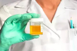 Yellow Urine Indicate a Liver Problem: పసుపు రంగు మూత్రం కాలేయ సమస్యకు సంకేతమా? నిపుణుల కీలక విశ్లేషణ.. Yellow Urine Indicate a Liver Problem: పసుపు రంగు మూత్రం కాలేయ సమస్యకు సంకేతమా? నిపుణుల కీలక విశ్లేషణ..