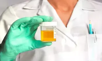 Yellow Urine Indicate a Liver Problem: పసుపు రంగు మూత్రం కాలేయ సమస్యకు సంకేతమా? నిపుణుల కీలక విశ్లేషణ..