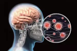 Leptospirosis and Encephalitis: మెదడును గుల్ల చేసే ప్రమాదకర ఇన్ఫెక్షన్లు.. లెప్టోస్పైరోసిస్, ఎన్సెఫాలిటిస్ ఎంతటి ప్రమాదకరం? Leptospirosis and Encephalitis: మెదడును గుల్ల చేసే ప్రమాదకర ఇన్ఫెక్షన్లు.. లెప్టోస్పైరోసిస్, ఎన్సెఫాలిటిస్ ఎంతటి ప్రమాదకరం?