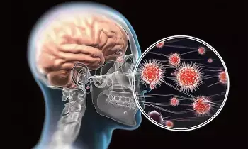 Leptospirosis and Encephalitis: మెదడును గుల్ల చేసే ప్రమాదకర ఇన్ఫెక్షన్లు..  లెప్టోస్పైరోసిస్, ఎన్సెఫాలిటిస్ ఎంతటి ప్రమాదకరం?