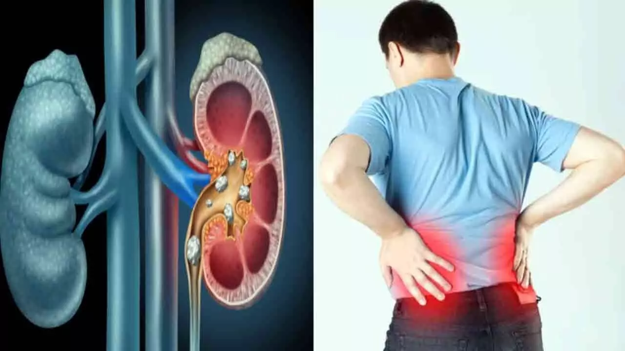 Kidneys at Risk: వర్షాకాలం వచ్చేసింది.. ఈ తప్పు చేస్తే మీ కిడ్నీలు డేంజర్ లో పడ్డట్టే! Kidneys at Risk: వర్షాకాలం వచ్చేసింది.. ఈ తప్పు చేస్తే మీ కిడ్నీలు డేంజర్ లో పడ్డట్టే!