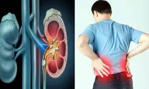 Kidneys at Risk: వర్షాకాలం వచ్చేసింది.. ఈ తప్పు చేస్తే మీ కిడ్నీలు డేంజర్ లో పడ్డట్టే! Kidneys at Risk: వర్షాకాలం వచ్చేసింది.. ఈ తప్పు చేస్తే మీ కిడ్నీలు డేంజర్ లో పడ్డట్టే!