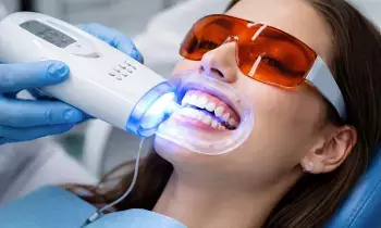 Teeth Whitening: టీత్ వైట్నింగ్ చేయించుకుంటున్నారా? మరకలు పోతాయా? ఎవరెవరు ఈ చికిత్సకు దూరంగా ఉండాలి?