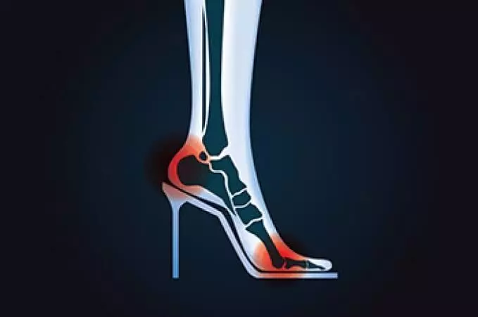 Wear High Heels Every Day for Style: హై హీల్స్ స్టైలిష్గా ఉన్నాయని రోజూ వేసుకుంటున్నారా? మీ వెన్ను, పాదాలు డేంజర్లో పడ్డట్టే.. Wear High Heels Every Day for Style: హై హీల్స్ స్టైలిష్గా ఉన్నాయని రోజూ వేసుకుంటున్నారా? మీ వెన్ను, పాదాలు డేంజర్లో పడ్డట్టే..