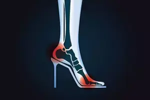 Wear High Heels Every Day for Style: హై హీల్స్ స్టైలిష్గా ఉన్నాయని రోజూ వేసుకుంటున్నారా? మీ వెన్ను, పాదాలు డేంజర్లో పడ్డట్టే.. Wear High Heels Every Day for Style: హై హీల్స్ స్టైలిష్గా ఉన్నాయని రోజూ వేసుకుంటున్నారా? మీ వెన్ను, పాదాలు డేంజర్లో పడ్డట్టే..