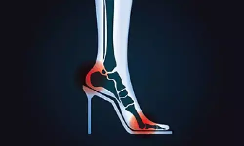 Wear High Heels Every Day for Style: హై హీల్స్ స్టైలిష్గా ఉన్నాయని రోజూ వేసుకుంటున్నారా? మీ వెన్ను, పాదాలు డేంజర్లో పడ్డట్టే.. Wear High Heels Every Day for Style: హై హీల్స్ స్టైలిష్గా ఉన్నాయని రోజూ వేసుకుంటున్నారా? మీ వెన్ను, పాదాలు డేంజర్లో పడ్డట్టే..