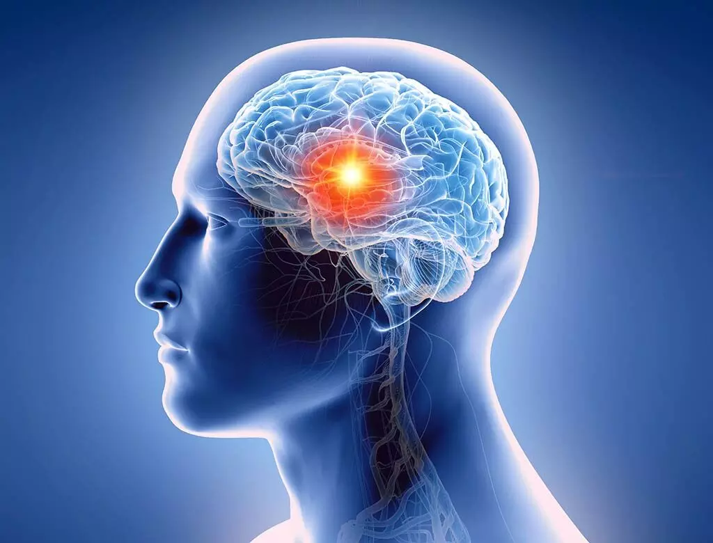 Waking Up With a Headache: ఉదయాన్నే తలనొప్పి వేధిస్తోందా? మెదడు కణితి ప్రారంభ లక్షణాలపై నిపుణుల హెచ్చరిక Waking Up With a Headache: ఉదయాన్నే తలనొప్పి వేధిస్తోందా? మెదడు కణితి ప్రారంభ లక్షణాలపై నిపుణుల హెచ్చరిక