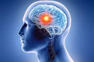 Waking Up With a Headache: ఉదయాన్నే తలనొప్పి వేధిస్తోందా? మెదడు కణితి ప్రారంభ లక్షణాలపై నిపుణుల హెచ్చరిక Waking Up With a Headache: ఉదయాన్నే తలనొప్పి వేధిస్తోందా? మెదడు కణితి ప్రారంభ లక్షణాలపై నిపుణుల హెచ్చరిక