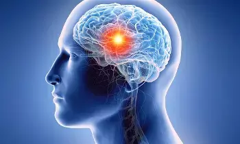 Waking Up With a Headache: ఉదయాన్నే తలనొప్పి వేధిస్తోందా? మెదడు కణితి ప్రారంభ లక్షణాలపై నిపుణుల హెచ్చరిక