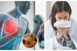 Swine Flu: దేశంలో పెరుగుతున్న స్వైన్ ఫ్లూ కేసులు.. భయం వద్దు.. ఈ జాగ్రత్తలతో అప్రమత్తంగా ఉండండి.. Swine Flu: దేశంలో పెరుగుతున్న స్వైన్ ఫ్లూ కేసులు.. భయం వద్దు.. ఈ జాగ్రత్తలతో అప్రమత్తంగా ఉండండి..