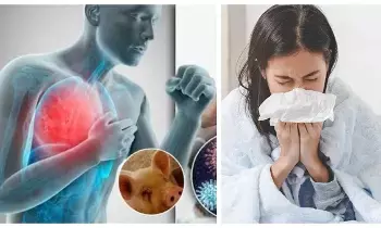 Swine Flu: దేశంలో పెరుగుతున్న స్వైన్ ఫ్లూ కేసులు.. భయం వద్దు.. ఈ జాగ్రత్తలతో అప్రమత్తంగా ఉండండి..