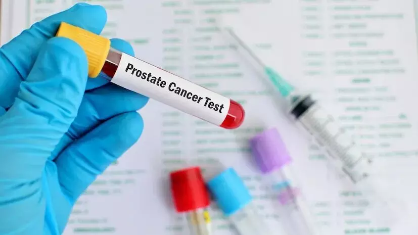 Cancer: క్యాన్సర్పై అనుమానమా? నిర్ధారణ కోసం చేయించుకోవాల్సిన ముఖ్యమైన పరీక్షలివే.. Cancer: క్యాన్సర్పై అనుమానమా? నిర్ధారణ కోసం చేయించుకోవాల్సిన ముఖ్యమైన పరీక్షలివే..