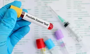 Cancer: క్యాన్సర్పై అనుమానమా? నిర్ధారణ కోసం చేయించుకోవాల్సిన ముఖ్యమైన పరీక్షలివే.. Cancer: క్యాన్సర్పై అనుమానమా? నిర్ధారణ కోసం చేయించుకోవాల్సిన ముఖ్యమైన పరీక్షలివే..