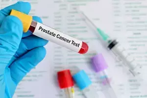 Cancer: క్యాన్సర్పై అనుమానమా? నిర్ధారణ కోసం చేయించుకోవాల్సిన ముఖ్యమైన పరీక్షలివే.. Cancer: క్యాన్సర్పై అనుమానమా? నిర్ధారణ కోసం చేయించుకోవాల్సిన ముఖ్యమైన పరీక్షలివే..
