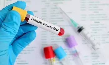 Cancer: క్యాన్సర్‌పై అనుమానమా? నిర్ధారణ కోసం చేయించుకోవాల్సిన ముఖ్యమైన పరీక్షలివే..