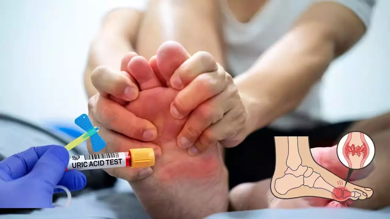 High Uric Acid: శరీరంలో యూరిక్ యాసిడ్ పెరిగిందా? ఏ పండ్లు తినాలి.. వేటికి దూరంగా ఉండాలి? High Uric Acid: శరీరంలో యూరిక్ యాసిడ్ పెరిగిందా? ఏ పండ్లు తినాలి.. వేటికి దూరంగా ఉండాలి?