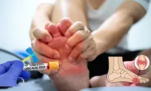 High Uric Acid: శరీరంలో యూరిక్ యాసిడ్ పెరిగిందా? ఏ పండ్లు తినాలి.. వేటికి దూరంగా ఉండాలి? High Uric Acid: శరీరంలో యూరిక్ యాసిడ్ పెరిగిందా? ఏ పండ్లు తినాలి.. వేటికి దూరంగా ఉండాలి?