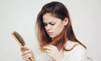 Severe Stress and Anxiety Causing Hair Loss: తీవ్రమైన ఒత్తిడి, ఆందోళనతో జుట్టు రాలుతోందా? నిపుణులు చెబుతున్న వాస్తవాలివే