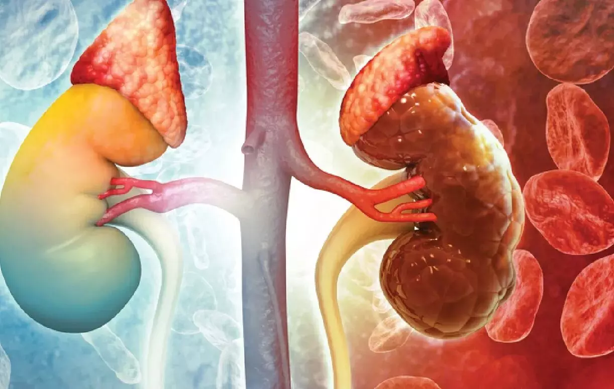 Painkillers Damaging Your Kidneys: నొప్పి తగ్గించే మాత్రలే కిడ్నీలను మింగేస్తున్నాయా? ఈ నిజం తెలుసుకోవాల్సిందే.. Painkillers Damaging Your Kidneys: నొప్పి తగ్గించే మాత్రలే కిడ్నీలను మింగేస్తున్నాయా? ఈ నిజం తెలుసుకోవాల్సిందే..