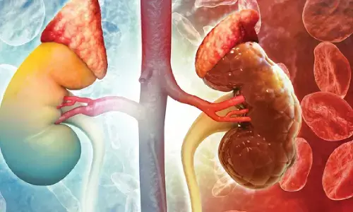 Painkillers Damaging Your Kidneys: నొప్పి తగ్గించే మాత్రలే కిడ్నీలను మింగేస్తున్నాయా? ఈ నిజం తెలుసుకోవాల్సిందే.. Painkillers Damaging Your Kidneys: నొప్పి తగ్గించే మాత్రలే కిడ్నీలను మింగేస్తున్నాయా? ఈ నిజం తెలుసుకోవాల్సిందే..