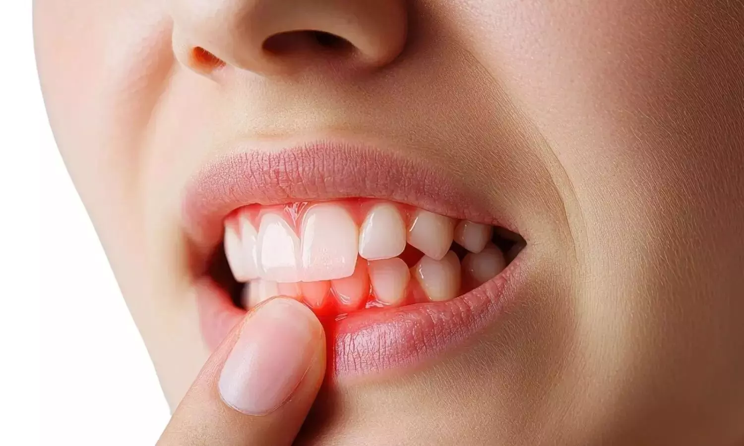 Bleeding Gums While Brushing: బ్రష్ చేసేటప్పుడు చిగుళ్ల నుంచి రక్తం వస్తోందా? Bleeding Gums While Brushing: బ్రష్ చేసేటప్పుడు చిగుళ్ల నుంచి రక్తం వస్తోందా?