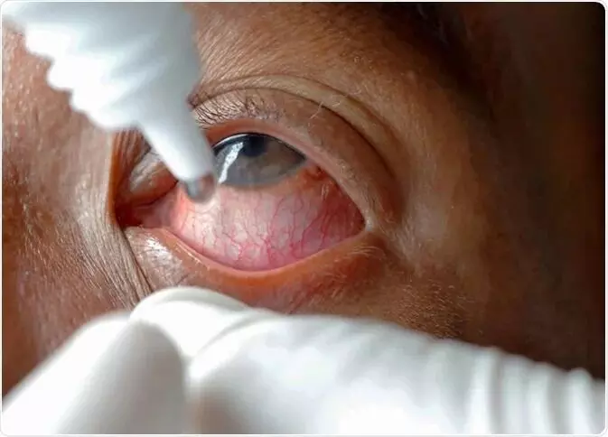 Eye Drops: కంటి చుక్కల మందు వాడుతున్నారా? సీల్ తెరిచిన తర్వాత నెలలు గడిస్తే కంటిచూపుకే ప్రమాదం Eye Drops: కంటి చుక్కల మందు వాడుతున్నారా? సీల్ తెరిచిన తర్వాత నెలలు గడిస్తే కంటిచూపుకే ప్రమాదం