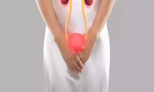 Burning or Pain While Urinating in Women: మహిళల్లో మూత్రవిసర్జన సమయంలో మంట, నొప్పి వేధిస్తున్నాయా? నిపుణులు ఏమంటున్నారంటే Burning or Pain While Urinating in Women: మహిళల్లో మూత్రవిసర్జన సమయంలో మంట, నొప్పి వేధిస్తున్నాయా? నిపుణులు ఏమంటున్నారంటే