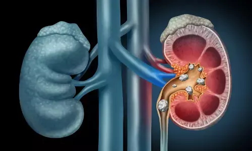 Kidney Stones: కిడ్నీలో రాళ్లు రావడానికి మన రోజువారీ ఈ అలవాట్లే అసలు కారణం.. Kidney Stones: కిడ్నీలో రాళ్లు రావడానికి మన రోజువారీ ఈ అలవాట్లే అసలు కారణం..