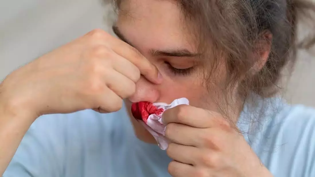 Nosebleed: ముక్కు నుంచి రక్తం కారడం సాధారణమేనా? సైనస్ క్యాన్సర్కు సంబంధించిన వీటిని విస్మరించవద్దు.. Nosebleed: ముక్కు నుంచి రక్తం కారడం సాధారణమేనా? సైనస్ క్యాన్సర్కు సంబంధించిన వీటిని విస్మరించవద్దు..