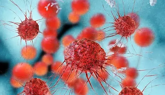 Don’t Ignore Infections: ఇన్ఫెక్షన్లను తేలిగ్గా తీసుకోకండి.. క్యాన్సర్కు దారితీయొచ్చు.. అధ్యయనంలో సంచలన విషయాలు.. Don’t Ignore Infections: ఇన్ఫెక్షన్లను తేలిగ్గా తీసుకోకండి.. క్యాన్సర్కు దారితీయొచ్చు.. అధ్యయనంలో సంచలన విషయాలు..