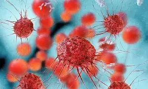 Don’t Ignore Infections: ఇన్ఫెక్షన్లను తేలిగ్గా తీసుకోకండి.. క్యాన్సర్కు దారితీయొచ్చు.. అధ్యయనంలో సంచలన విషయాలు.. Don’t Ignore Infections: ఇన్ఫెక్షన్లను తేలిగ్గా తీసుకోకండి.. క్యాన్సర్కు దారితీయొచ్చు.. అధ్యయనంలో సంచలన విషయాలు..