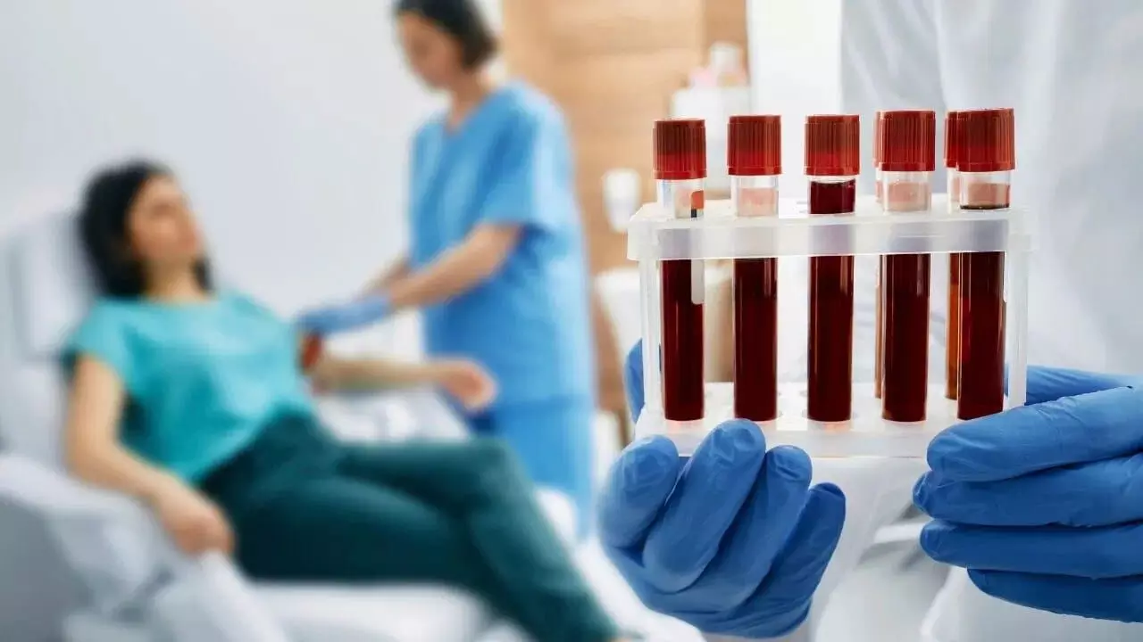 Routine CBC Blood Test Detect Blood Cancer: సాధారణ CBC రక్త పరీక్షతో బ్లడ్ క్యాన్సర్ను గుర్తించవచ్చా? నిపుణులు ఏమంటున్నారు? Routine CBC Blood Test Detect Blood Cancer: సాధారణ CBC రక్త పరీక్షతో బ్లడ్ క్యాన్సర్ను గుర్తించవచ్చా? నిపుణులు ఏమంటున్నారు?