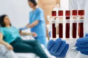 Routine CBC Blood Test Detect Blood Cancer: సాధారణ CBC రక్త పరీక్షతో బ్లడ్ క్యాన్సర్ను గుర్తించవచ్చా? నిపుణులు ఏమంటున్నారు? Routine CBC Blood Test Detect Blood Cancer: సాధారణ CBC రక్త పరీక్షతో బ్లడ్ క్యాన్సర్ను గుర్తించవచ్చా? నిపుణులు ఏమంటున్నారు?