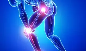 Mistaking Joint Pain for Fatigue: కీళ్ల నొప్పులను అలసట అనుకుని నిర్లక్ష్యం చేస్తున్నారా? ఇది ఆర్థరైటిస్.. ముందస్తు హెచ్చరిక కావచ్చు..